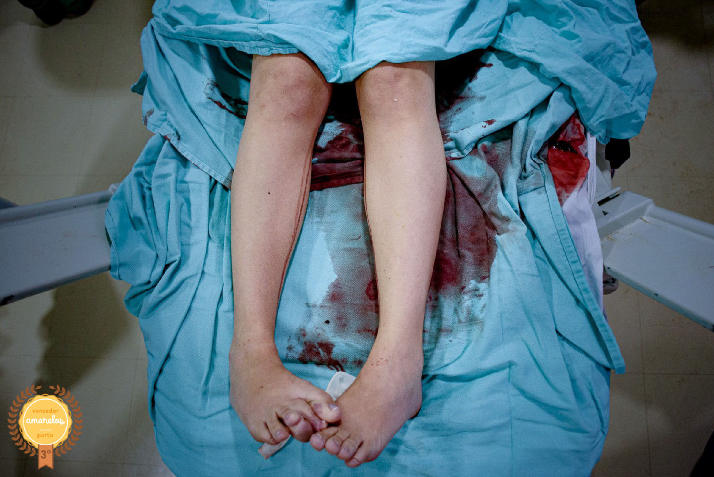 Fotografia de Parto
