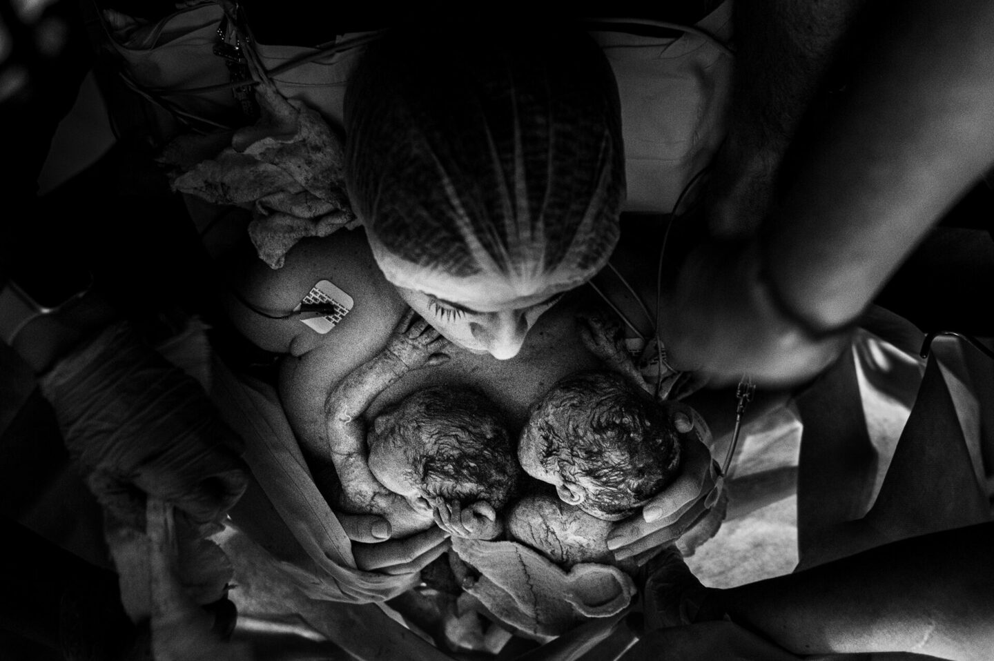 Fotografia de Parto - Parto de Gêmeos - Ribeirão Preto - SP -  Fabrício e Eduardo